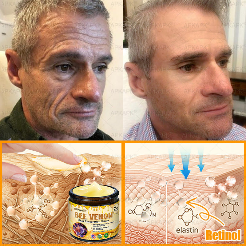 👨⚕️𝐌𝐚𝐝𝐞 𝐚𝐧𝐝 𝐬𝐡𝐢𝐩𝐩𝐞𝐝 𝐟𝐫𝐨𝐦 𝐔𝐒𝐀 ✨𝖠𝖯𝖪𝖠𝖯𝖪® 𝖡𝖾𝖾 𝗏𝖾𝗇𝗈𝗆 𝖲𝗄𝗂𝗇𝖱𝖾𝗌𝗍𝗈𝗋𝖺𝗍𝗂𝗈𝗇 𝖢𝗋𝖾𝖺𝗆