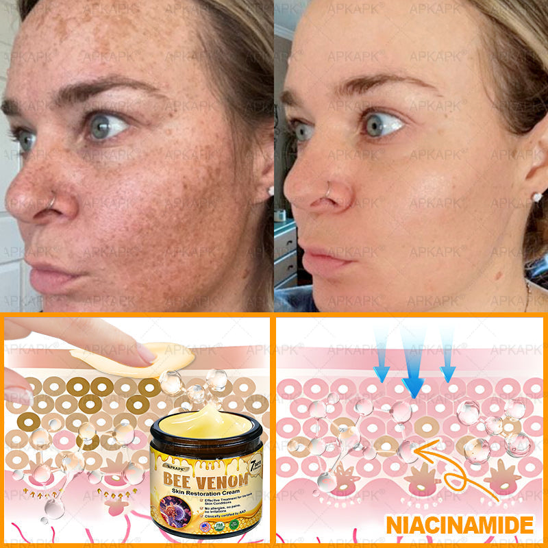 👨⚕️𝐌𝐚𝐝𝐞 𝐚𝐧𝐝 𝐬𝐡𝐢𝐩𝐩𝐞𝐝 𝐟𝐫𝐨𝐦 𝐔𝐒𝐀 ✨𝖠𝖯𝖪𝖠𝖯𝖪® 𝖡𝖾𝖾 𝗏𝖾𝗇𝗈𝗆 𝖲𝗄𝗂𝗇𝖱𝖾𝗌𝗍𝗈𝗋𝖺𝗍𝗂𝗈𝗇 𝖢𝗋𝖾𝖺𝗆