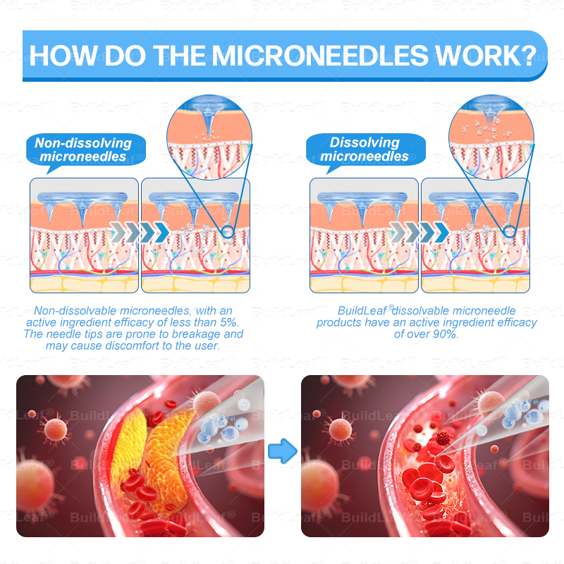 🎉 Congratulations! You've unlocked an exclusive offer for BuildLeaf® GLP-1 Slim & Firm Nano Microneedle Patch! Get an extra 30% OFF today as a thank-you! 👉 Click now – limited time only!