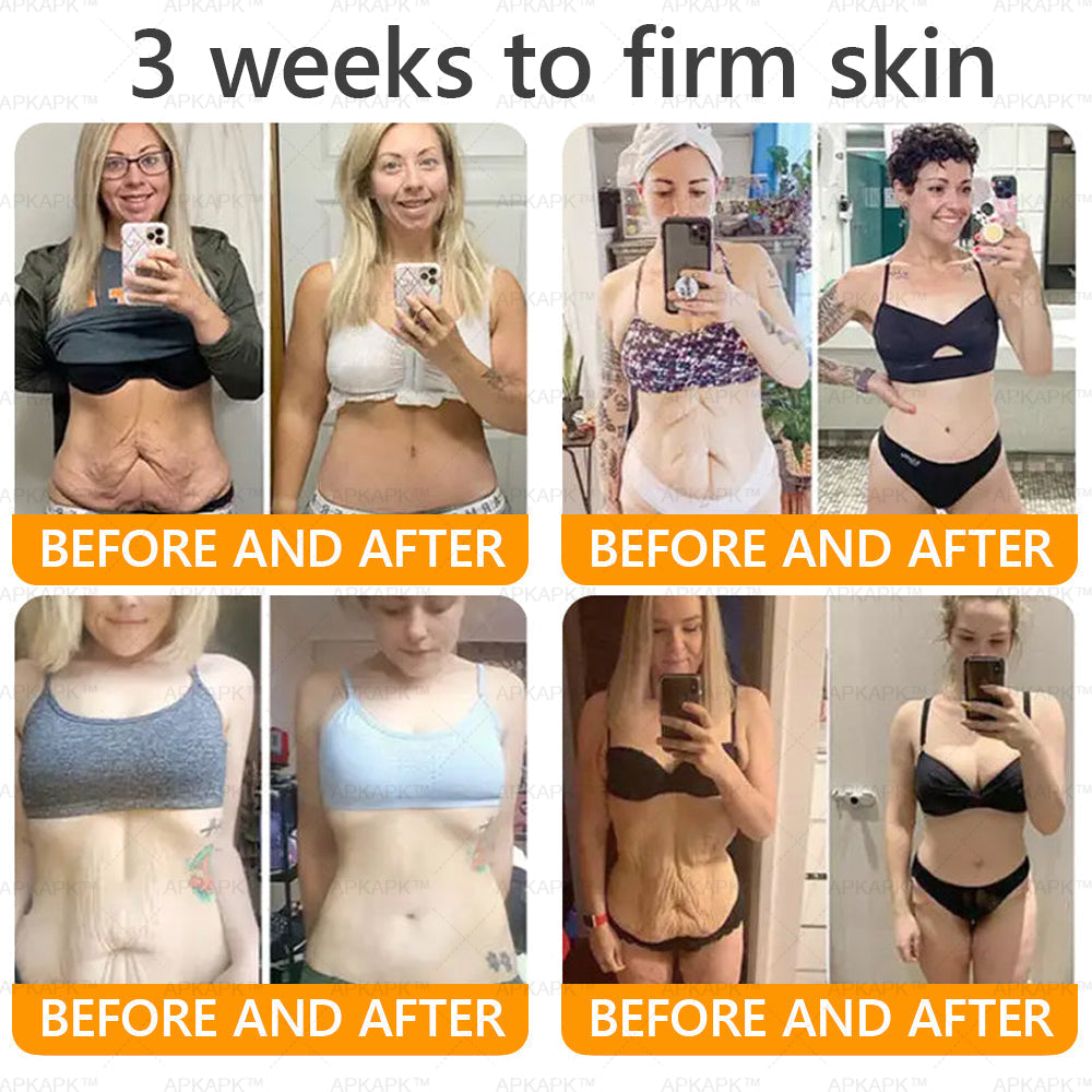 👨‍⚕️𝐌𝐇𝐑𝐀 Official Store Made and Shipped from USA ✨  APKAPK® Bee venom Comprehensive Cream with Collagen & Matrixyl 3000|Obesity🔥 Sagging Skin, Fine Lines, Loss of Firmness, Flat Bust, Drooping Hips, and More