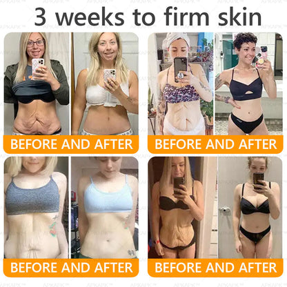 👨‍⚕️𝐌𝐇𝐑𝐀 Official Store Made and Shipped from USA ✨  APKAPK® Bee venom Comprehensive Cream with Collagen & Matrixyl 3000|Obesity🔥 Sagging Skin, Fine Lines, Loss of Firmness, Flat Bust, Drooping Hips, and More