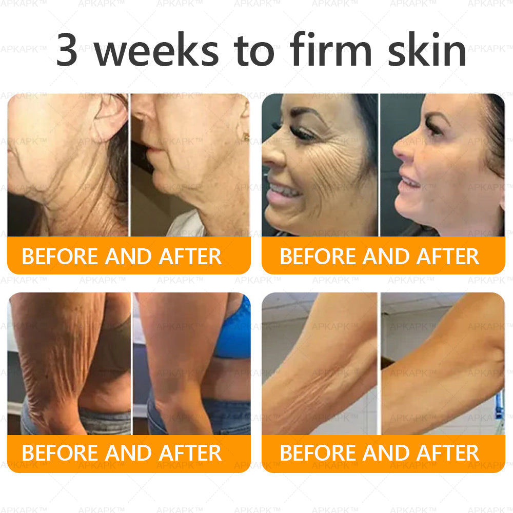 👨‍⚕️𝐌𝐇𝐑𝐀 Official Store Made and Shipped from USA ✨  APKAPK® Bee venom Comprehensive Cream with Collagen & Matrixyl 3000|Obesity🔥 Sagging Skin, Fine Lines, Loss of Firmness, Flat Bust, Drooping Hips, and More