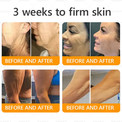 👨‍⚕️𝐌𝐇𝐑𝐀 Official Store Made and Shipped from USA ✨  APKAPK® Bee venom Comprehensive Cream with Collagen & Matrixyl 3000|Obesity🔥 Sagging Skin, Fine Lines, Loss of Firmness, Flat Bust, Drooping Hips, and More