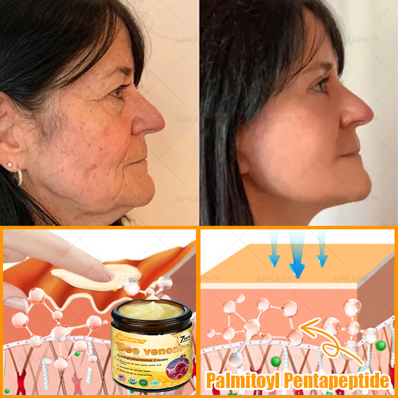 👨‍⚕️𝐌𝐇𝐑𝐀 Official Store Made and Shipped from USA ✨  APKAPK® Bee venom Comprehensive Cream with Collagen & Matrixyl 3000|Obesity🔥 Sagging Skin, Fine Lines, Loss of Firmness, Flat Bust, Drooping Hips, and More