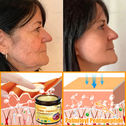 👨‍⚕️𝐌𝐇𝐑𝐀 Official Store Made and Shipped from USA ✨  APKAPK® Bee venom Comprehensive Cream with Collagen & Matrixyl 3000|Obesity🔥 Sagging Skin, Fine Lines, Loss of Firmness, Flat Bust, Drooping Hips, and More