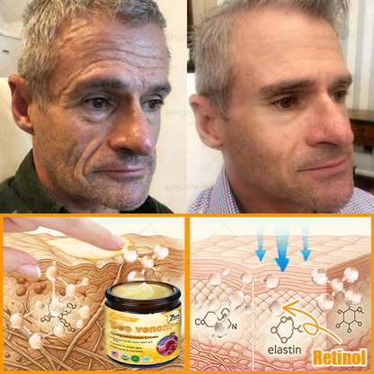 👨‍⚕️𝐌𝐇𝐑𝐀 Official Store Made and Shipped from USA ✨  APKAPK® Bee venom Comprehensive Cream with Collagen & Matrixyl 3000|Obesity🔥 Sagging Skin, Fine Lines, Loss of Firmness, Flat Bust, Drooping Hips, and More