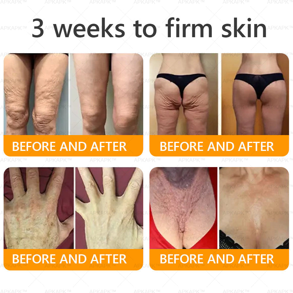 👨‍⚕️𝐌𝐇𝐑𝐀 Official Store Made and Shipped from USA ✨  APKAPK® Bee venom Comprehensive Cream with Collagen & Matrixyl 3000|Obesity🔥 Sagging Skin, Fine Lines, Loss of Firmness, Flat Bust, Drooping Hips, and More
