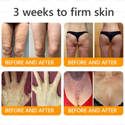 👨‍⚕️𝐌𝐇𝐑𝐀 Official Store Made and Shipped from USA ✨  APKAPK® Bee venom Comprehensive Cream with Collagen & Matrixyl 3000|Obesity🔥 Sagging Skin, Fine Lines, Loss of Firmness, Flat Bust, Drooping Hips, and More